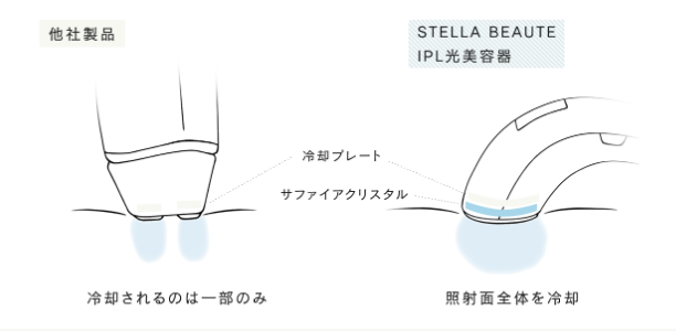 ステラボーテ　脱毛　効果